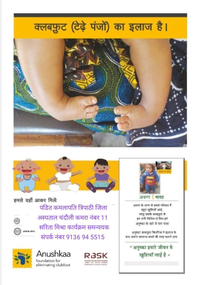 क्लब फुट क्लिनिक – नि:शुल्क उपचार केंद्र