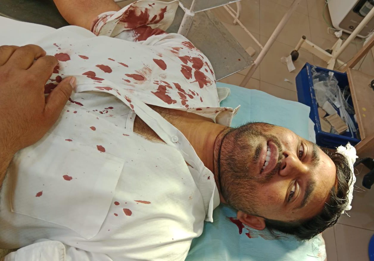 श्री प्रकाश इंटरमीडिएट कॉलेज में उपस्थिति को लेकर हुई मारपीट