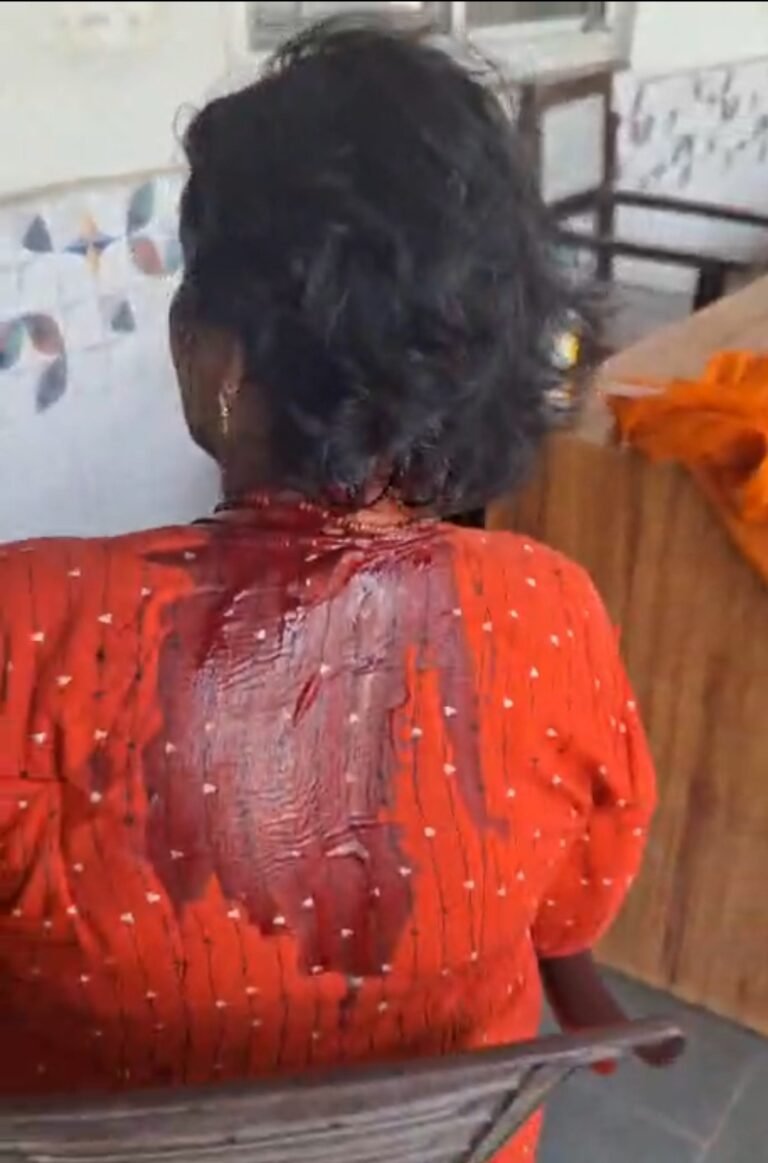 आपसी विवाद में पड़ोसी ने  बुजुर्ग महिला का फोड़ा सर, हालत गंभीर पुलिस का रवैया ढुलमुल
